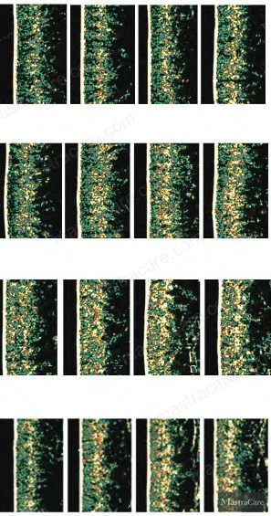 Figure 2: Ultrasound dermal density imaging comparison across test and control sides at D0, D7, D14, and D28