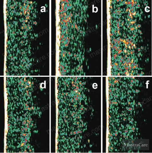 Figure 3: Skin thickness and density improvement images for 37-year-old volunteer at D0, D14, and D28 — treatment side vs. control side comparison using DermaLab Combo measurement